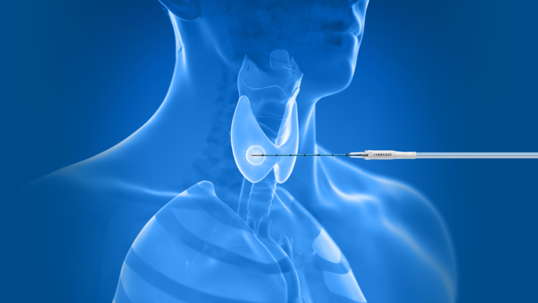 Thermoablation